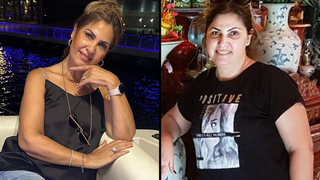 פרח סיסו, לפני ואחרי הטיפול בזאבת