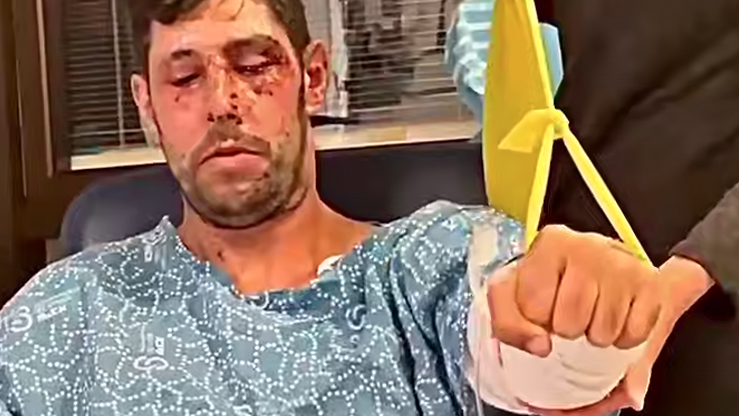 עידן עמדי בשיקום
