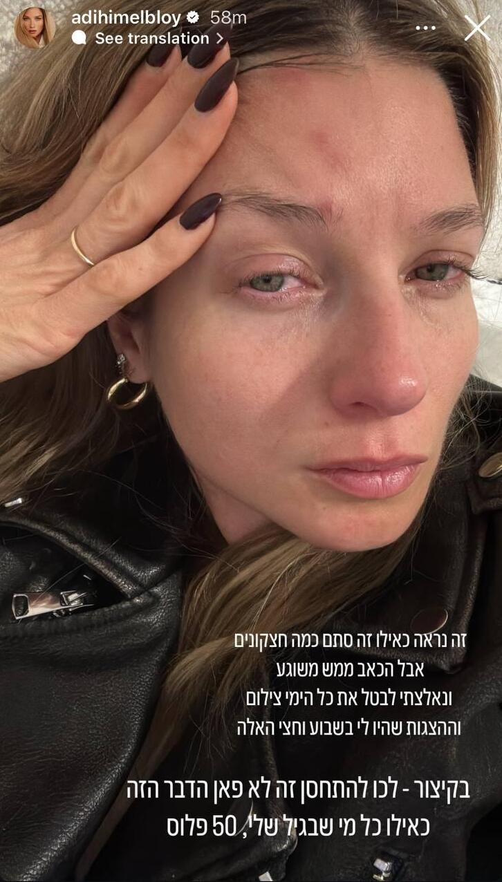 עדי הימלבלוי שלבקת חוגרת 