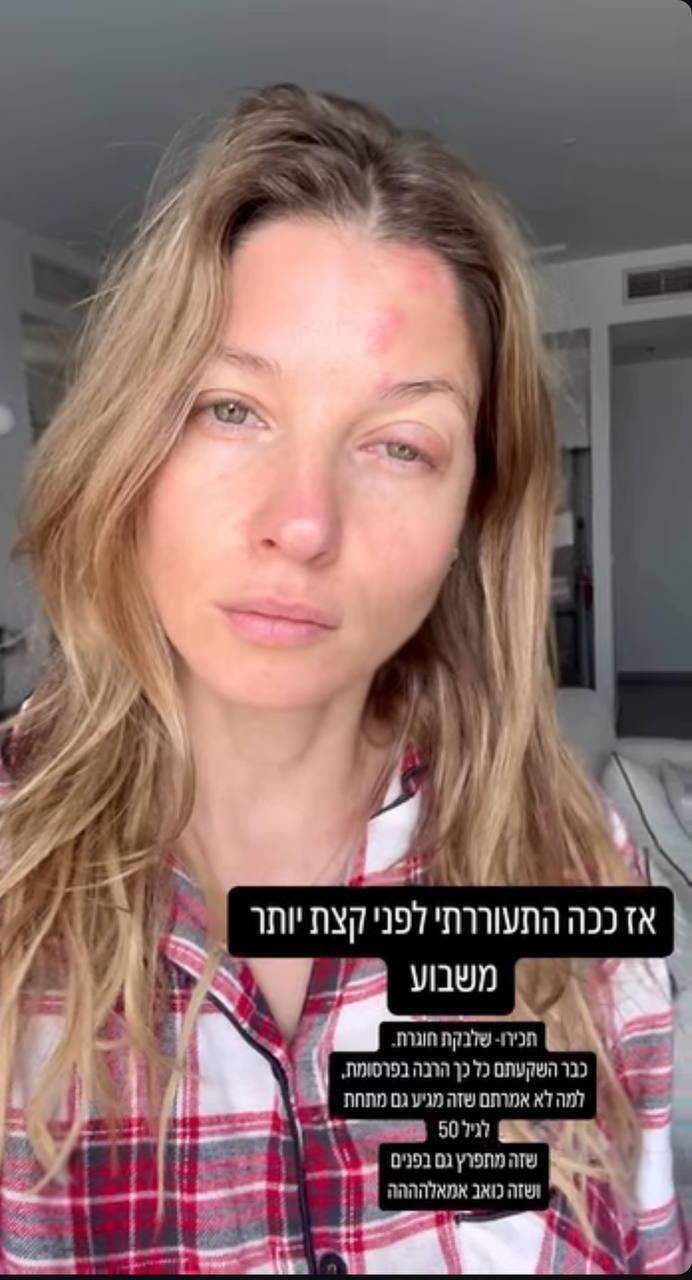 עדי הימלבלוי שלבקת חוגרת 