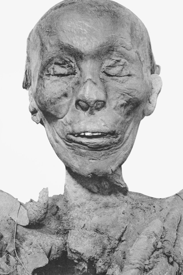 Mummy of King Thutmose II (Photo: G. Elliot Smith ) המומיה של המלך, שהתגלתה במאה ה-19