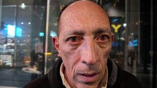 עמוס דורון, הותקף בהפגנה בבגין בגז פלפל