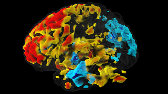 An fMRI image of a brain at rest 