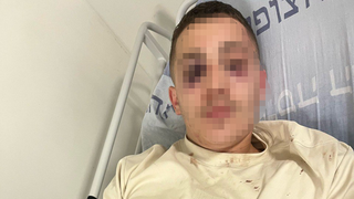הצעיר שהותקף בשוק מחנה יהודה בירושלים