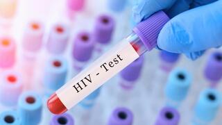 בדיקת HIV