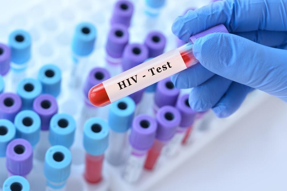 בדיקת HIV