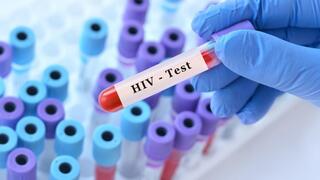 בדיקת HIV