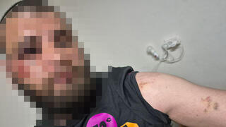 מהנדס חשמל מפורדיס הותקף באכזריות על ידי שוטרים כשרצה להיכנס למסגד אלאקצא