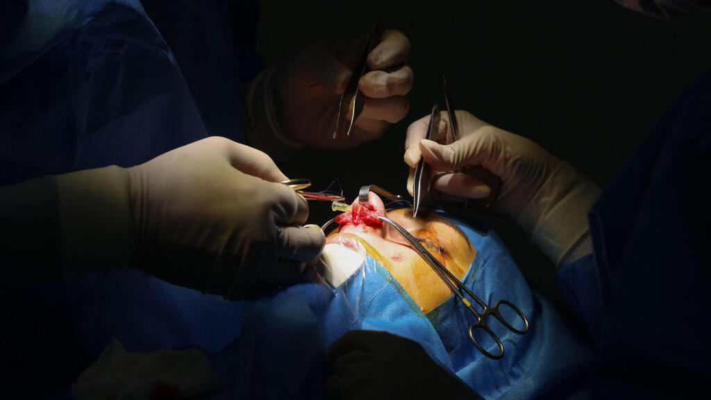 איראן ניתוח אף ניתוחים פלסטיים טהרן