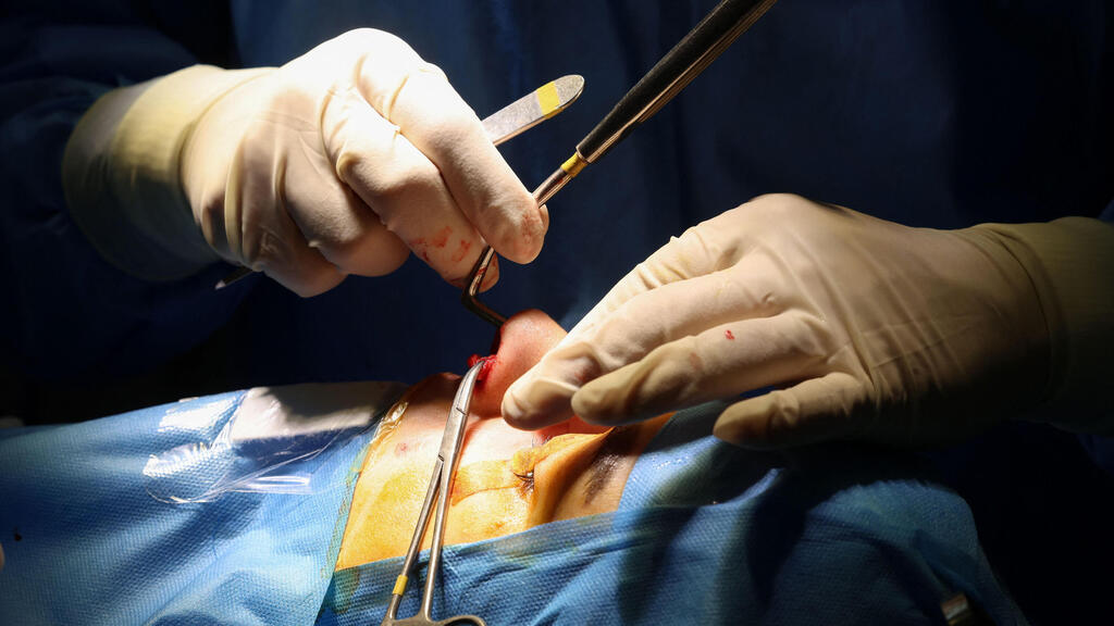 איראן ניתוח אף ניתוחים פלסטיים טהרן