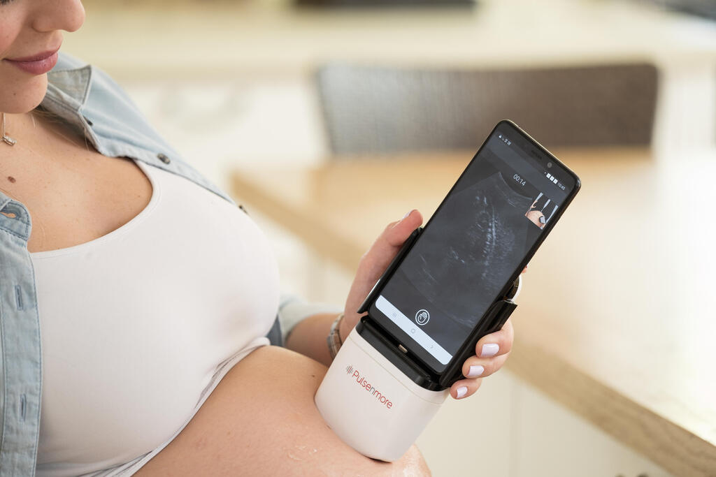 Pulsenmore: The first at-home ultrasound device