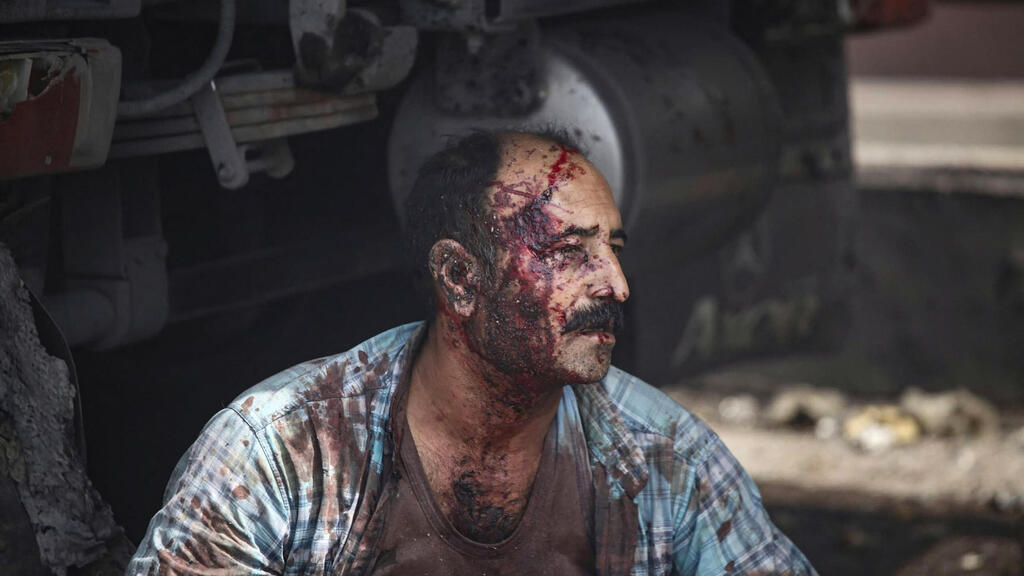 An injured man at the Iranian port near Bandar Abbas after the deadly explosion on Saturday (Photo: Mohammad Rasole Moradi / AFP) פיצוץ באיראן בנמל שהיד רג'אי