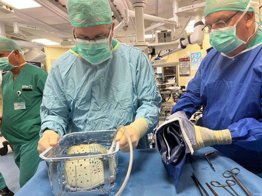 Surgeons prepare the Aeson artificial heart for transplantation (Photo: Sheba Hospital spokesperson) השתלת לב מלאכותי מתקדם Aeson מתוצרת CARMAT במרכז הרפואי שיבא