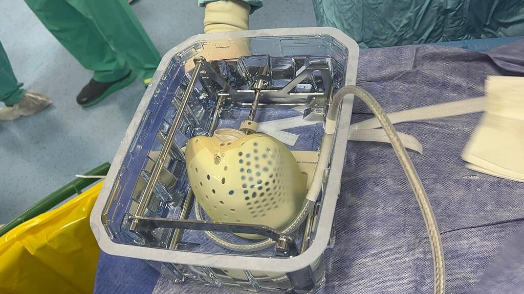 Advanced Aeson artificial heart manufactured by Carmat is ready in the operating room at Sheba Medical Center (Photo: Sheba Hospital spokesperson) השתלת לב מלאכותי מתקדם Aeson מתוצרת CARMAT במרכז הרפואי שיבא
