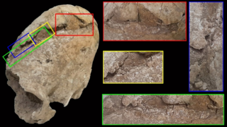 העדויות לפגיעה בגולגולת של האישה הצעירה מתקופת הנחושת, לרבות השבר המשולש (מסומן באדום) שנגרם מחפץ בעל קצה רחב, מה שהוביל למותה