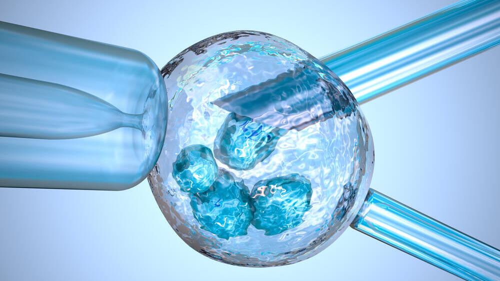 הפריה חוץ גופית