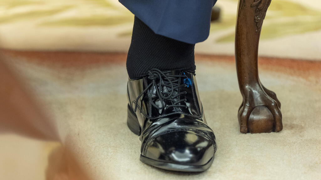 דונלד טראמפ קרסול נפוח