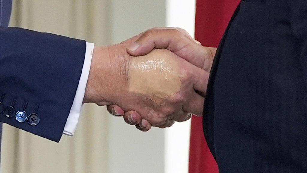 Синяк, покрытый мейкапом (Фото: AP/Alex Brandon) דונלד טראמפ יד חבולה