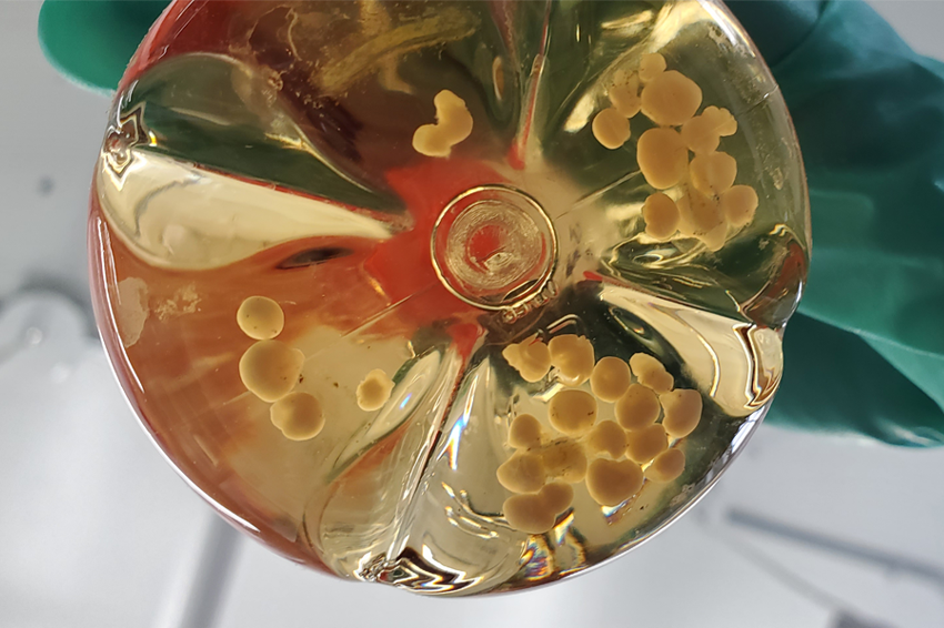 A model of “organoids”—tiny three-dimensional structures made of brain cell clusters. Brain organoids in a glass container 
