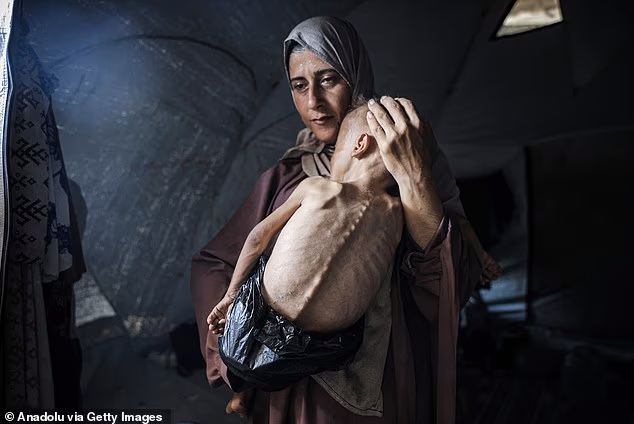 Gazan toddler Muhammad al-Matouq, who suffers from genetic diseases, with his mother Huda (Photo: Ahmad al-Arini of Anadolu) מוחמד זכריה איוב אל-מעתוק