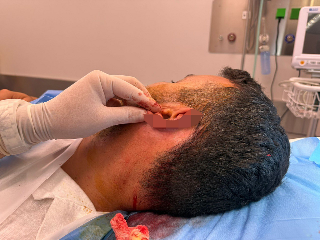 סתיו בן שושן הותקף בזמן חופשה באתונה