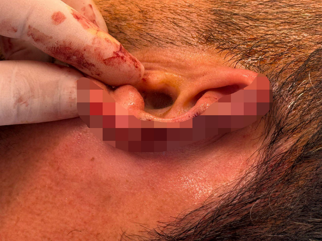 ستايو في فوسشن هوتكس بيزنس بيزنس باتون