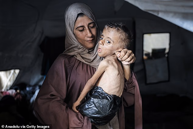 Gazan toddler Muhammad al-Matouq, who suffers from genetic diseases, with his mother Huda (Photo: Ahmad al-Arini of Anadolu) מוחמד זכריה איוב אל-מעתוק