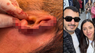סתיו בן שושן הותקף בזמן חופשה באתונה