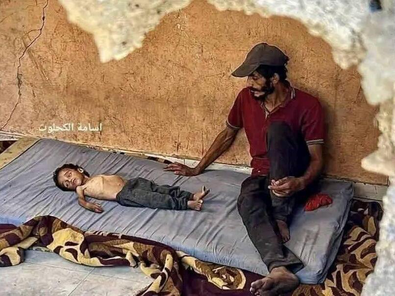 Some other Gaza kid, handled in Israel for genetic sickness, utilized by Hamas as image of famine