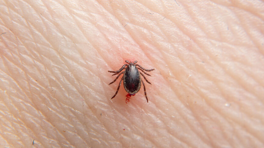 Клещ Borrelia burgdorferi