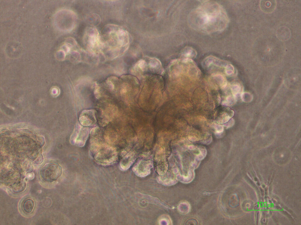 תמונה מיקרוסקופית של כליה הגדלה במעבדה מתאי גזע