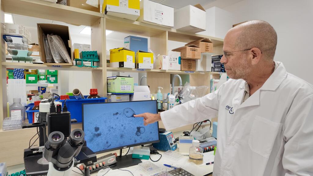 פרופ' בנימין דקל, נפרולוג מבית החולים שיבא, גידל רקמת כליה מתאי גזע