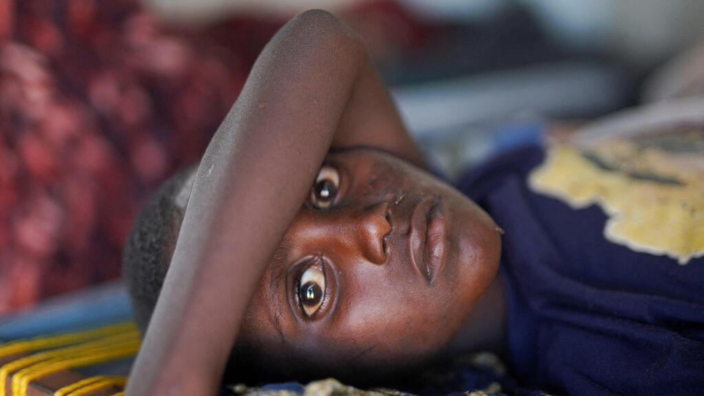 ילד ב סודן שחולה ב כולרה בעיר טווילה בחבל דרפור אליה ברחו תושבים מהעיר הנצורה אל-פשיר
