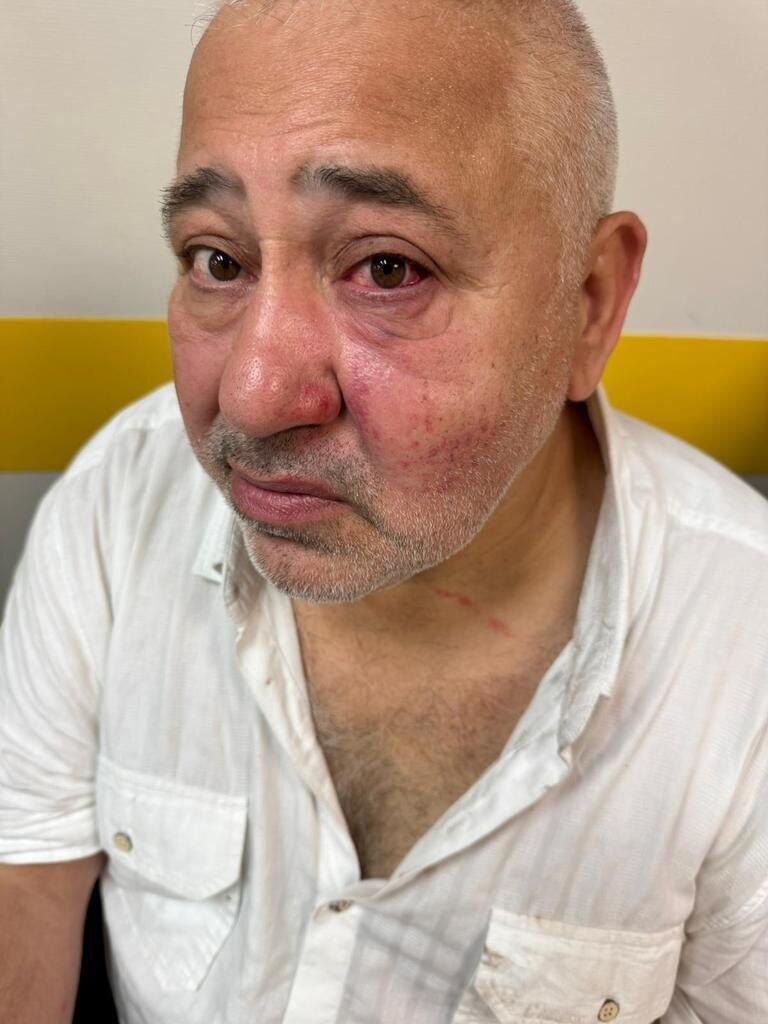  דובי סיטרוק, יהודי שהותקף בצרפת