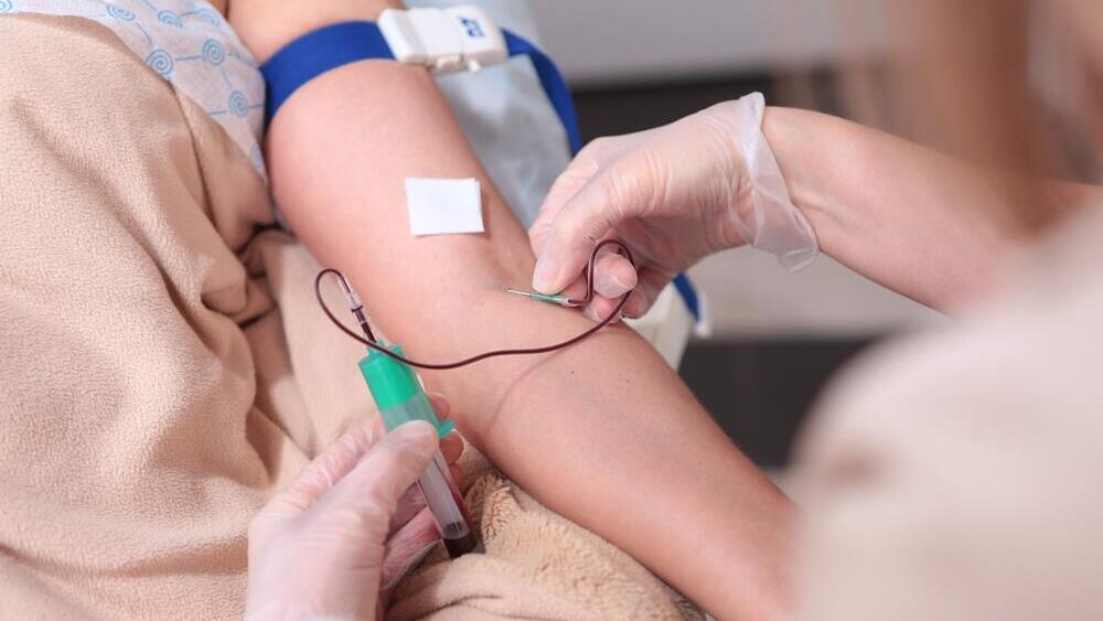 הליך אסתטי לשימור נעורים