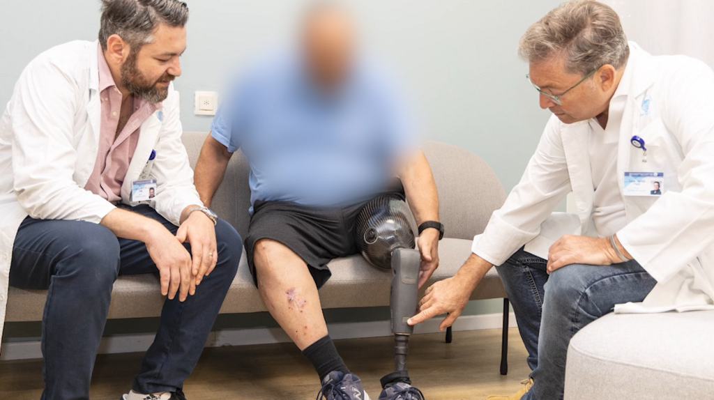 המרפאה באיכילוב לקטועי הגפיים