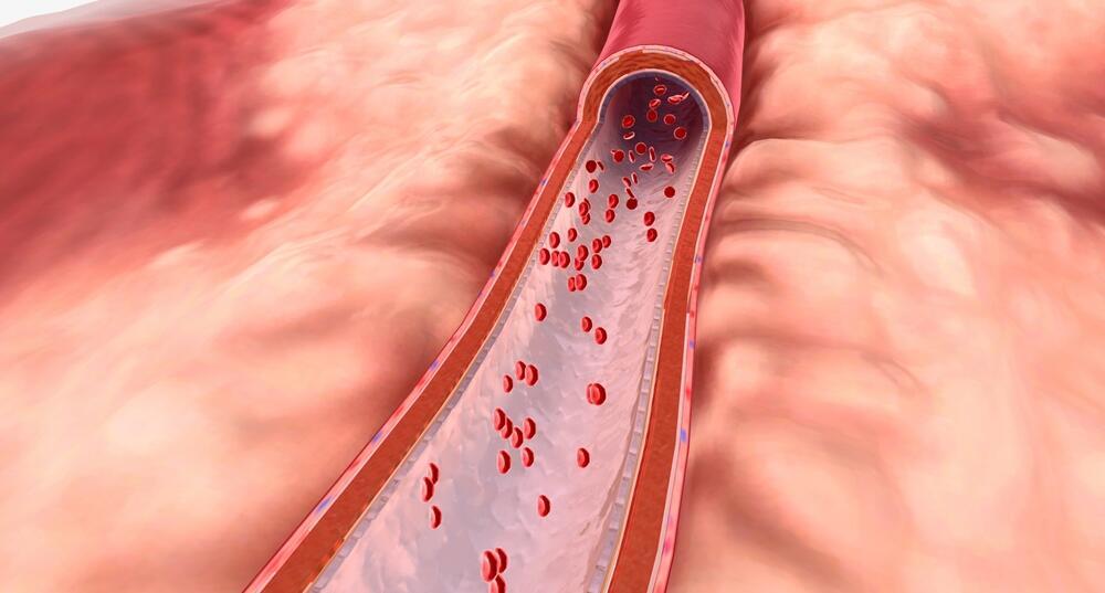 עורק, עורקים