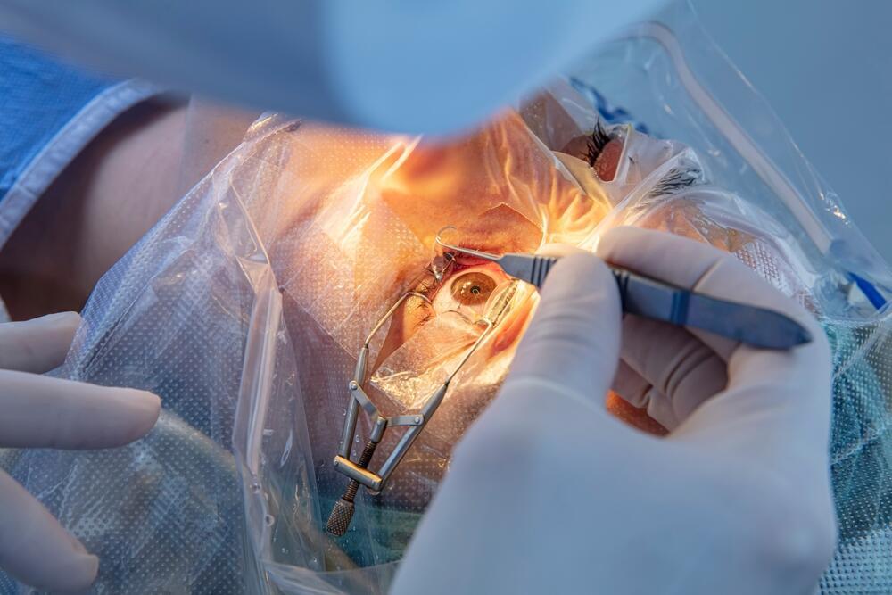 Strabismus surgery (Photo: Shutterstock) ניתוח פזילה