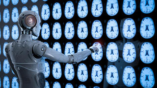 AI בשירות רדיולוגיה