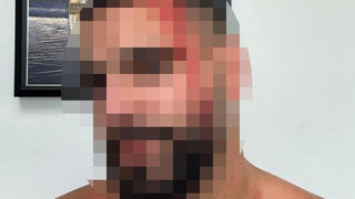 ישראלי שהותקף בלוס אנג'לס