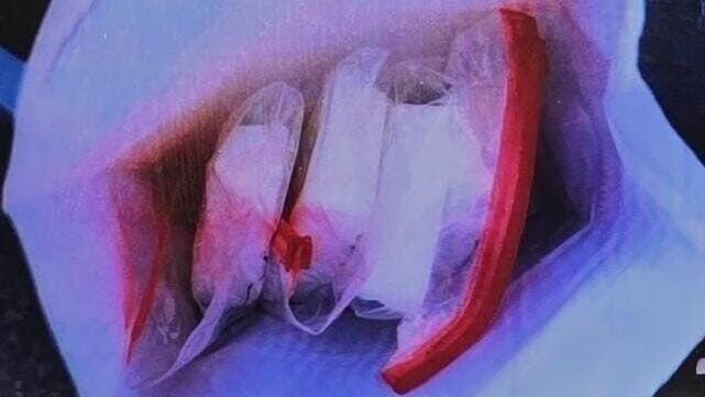 הסמים שנתפסו אצל הגננת