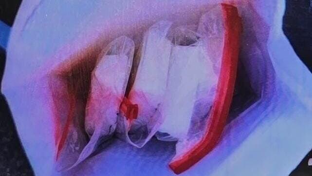 הסמים שנתפסו אצל הגננת