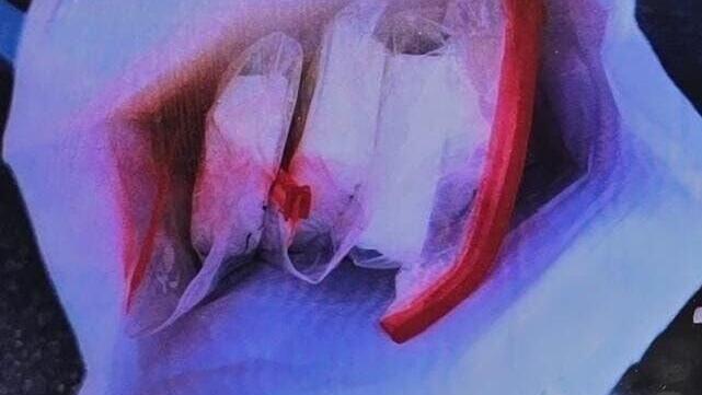 הסמים שנתפסו אצל הגננת