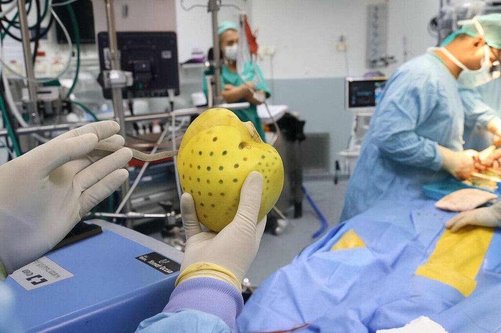 השתלת לב לאחר לב מלאכותי בבית החולים שיבא