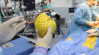 השתלת לב לאחר לב מלאכותי בבית החולים שיבא