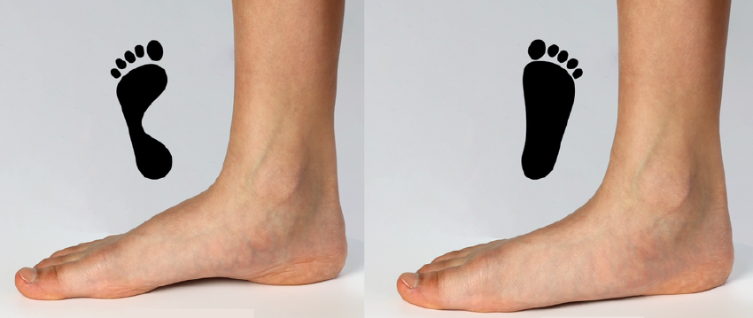 אינפו פלטפוס