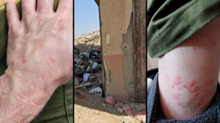 מכת פשפשים מאיימת על בריאות המילואימניקים  במגננים