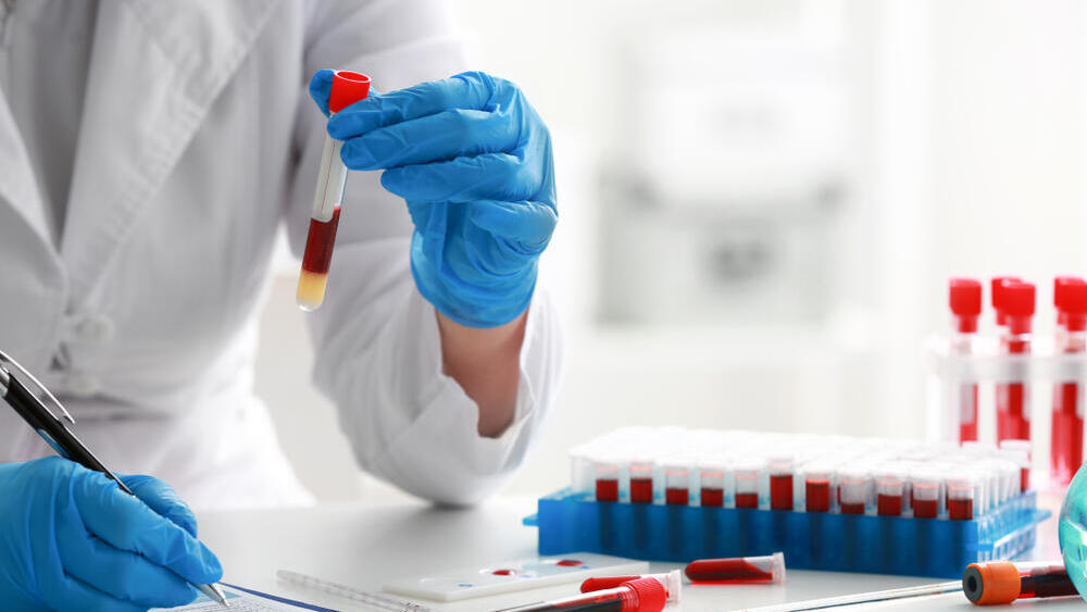 Фото: shutterstock בדיקת דם