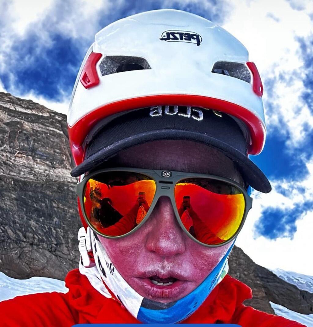 Danielle Wolfson with frostbite on her face after reaching the summit דניאל וולפסון עם כוויות קור על הפנים לאחר ההעפלה לפסגה