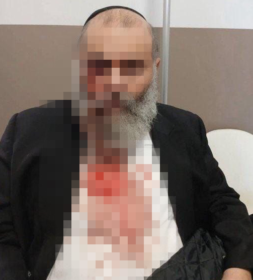 החרדי לאחר שהותקף